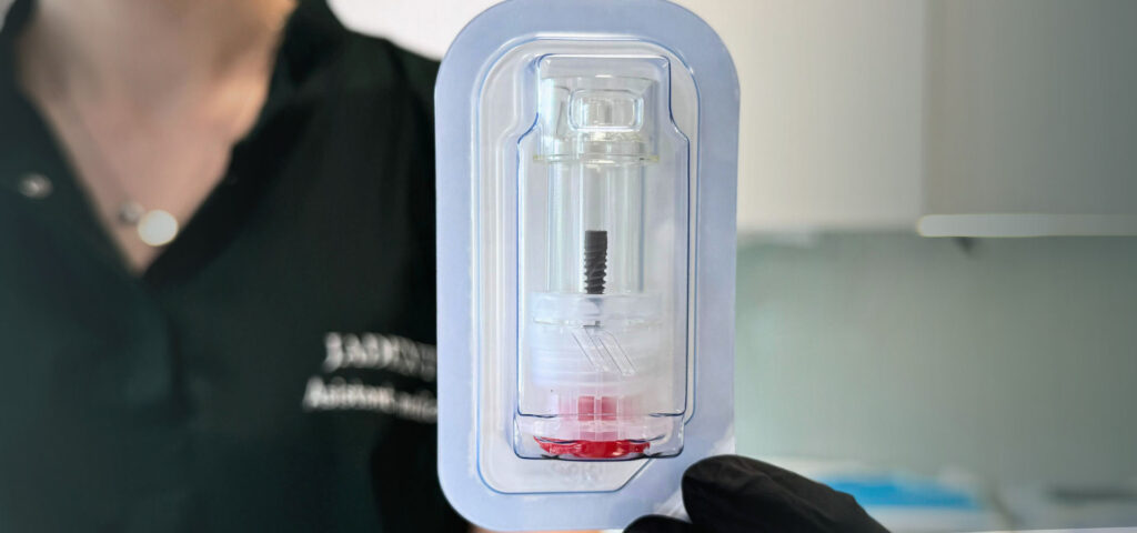 Implant dentar Suceava